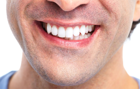 Whitening Essentials